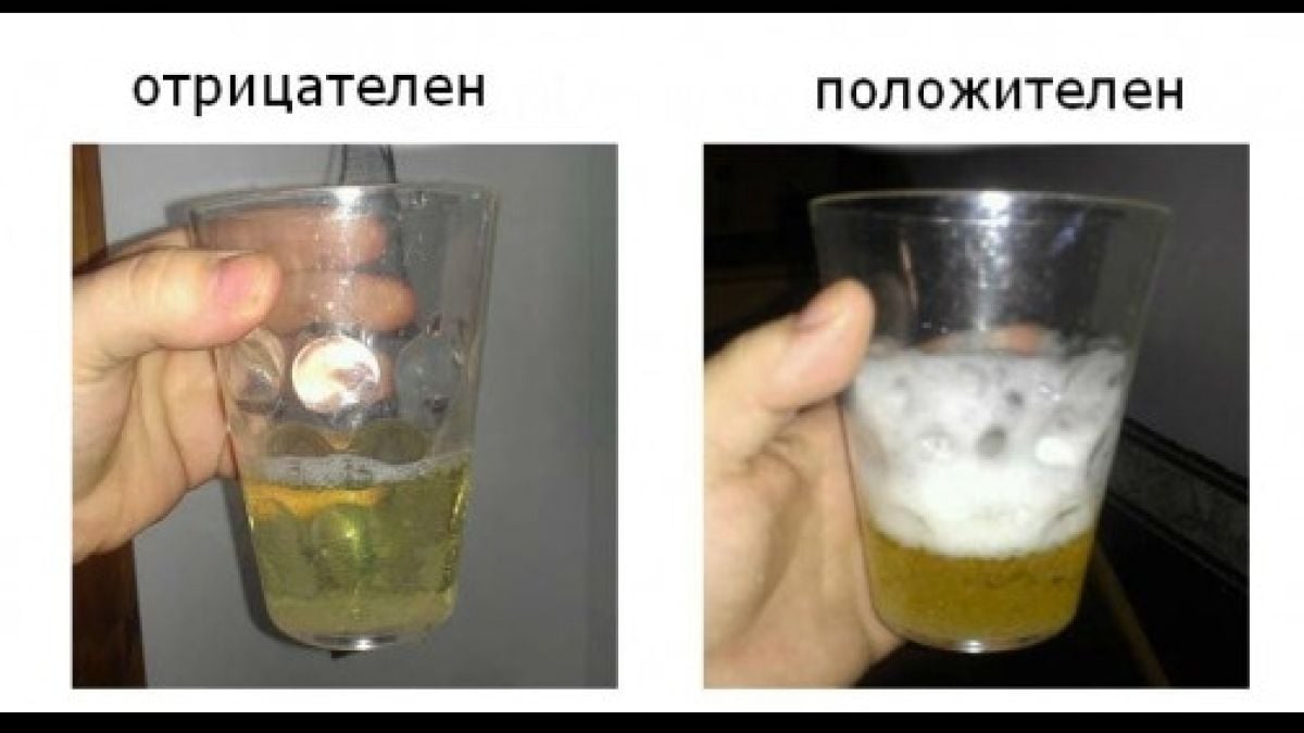 Ето как да проверите дали сте бременни сами вкъщи без тест