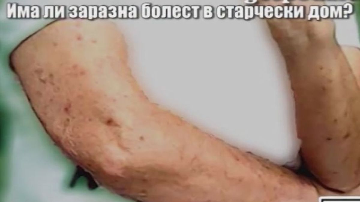 Като във филм на ужасите: Обитателите на старчески дом в София са целите в кръв! (ВИДЕО)