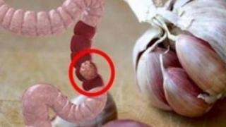Цели 80 процента могат да избегнат рак на дебелото черво, ако се придържат към това