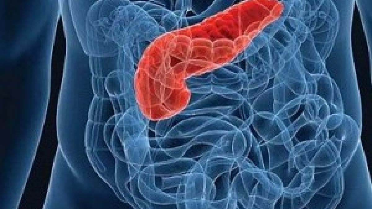 Тревожни предвестници: 8 ранни симптома за рак на панкреаса
