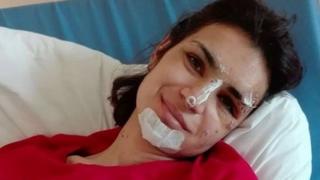 Страшната история на красивата Антония, която реши да се самоубие, но сега е без крака 
