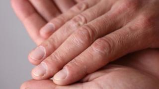 Почти всички имаме този симптом, а той говори за тежка болест