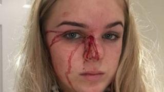 Млада красавица цяла година позволяваше на своя приятел да я пребива и изнасилва, но най-накрая се измъкна с хитрост (СНИМКИ 18+)