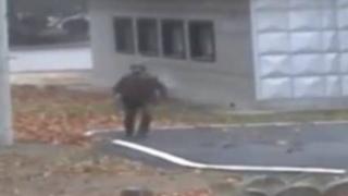 Хирурзи показаха каква страшна гадория е живяла в корема на войник, избягал от Северна Корея (СНИМКИ)