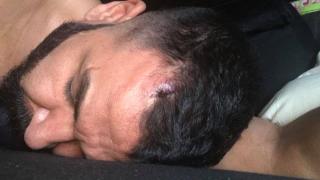 Първо в БЛИЦ! Шок: Азис направи най-кървавото си участие, пеейки с разбита глава пред 3000 души (СНИМКИ 18+)