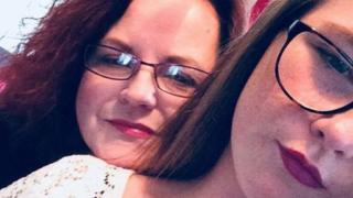 Грешно лекувана жена: Бактерия разяде вагината ми, тя никога повече няма да е същата