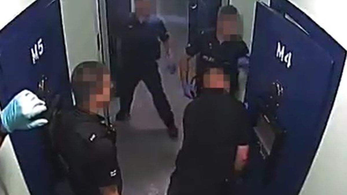 Полицаи случайно отрязаха пръстите на арестант (СНИМКИ/ВИДЕО 18+)