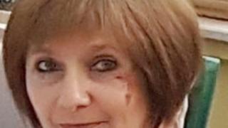 Д-р Мариана Москова обясни пред в. "ДОКТОР" цялата истина за проблемите при менструация и липсата на такава