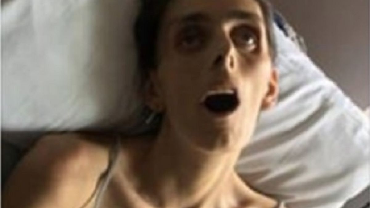 Фейсбук цензурира разтърсваща СНИМКА (18+) на млада жена, умираща от рак 