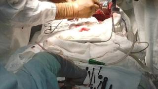 Нина дошла в болницата с висока температура. Няма да повярвате какво открили лекарите в корема й (СНИМКИ 18+)