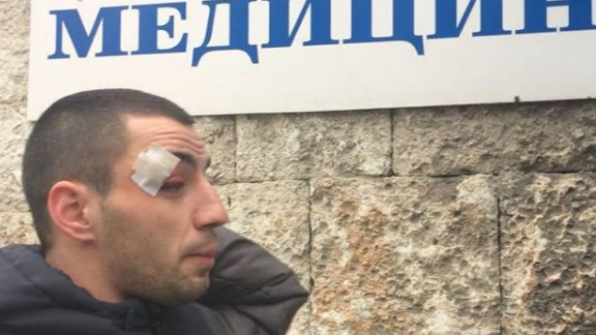 Нов брутален случай на полицейско насилие в Добрич! Ченгета смляха от бой младеж, дават му да пие вода от спринцовка
