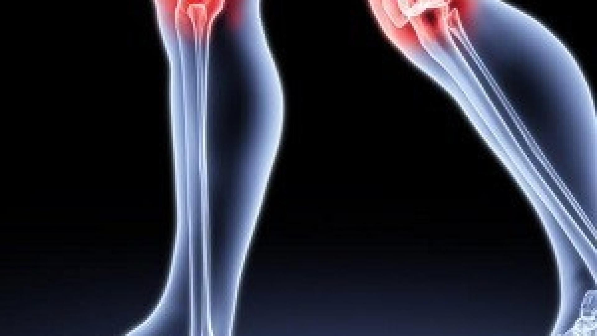 Има растение, което ще ви избави от болките в ставите