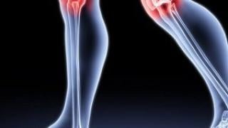 Има растение, което ще ви избави от болките в ставите