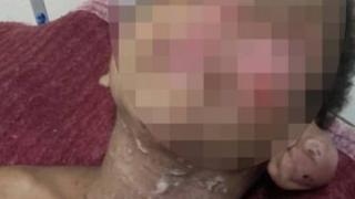 Заливан с вряла вода и бит като куче: Семейство осинови дете, за да го използва за ритуали с черни магии (СНИМКИ 18+)