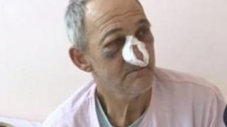 Животът нанесе нов удар на Димитър Златков! През лятото големият пожар в Кресненското дефиле го остави без дом, а сега... 