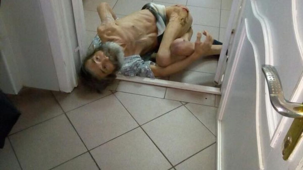 Жестока СНИМКА 18+ на безпомощен старец, лежащ на студения под в руска болница, взриви мрежата 