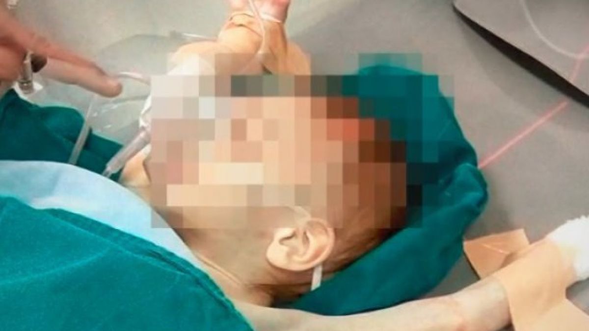 Най-сетне добра новина за 3-годишното близначе, което изпадна в кома след инцидент в дома си 