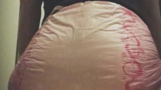 18-годишна носи памперси и живее като бебе, причината ще ви смае (СНИМКИ)