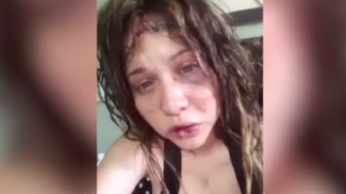 Шок! Моделка качи брутално ВИДЕО 18+, в което се оплаква, че гаджето й я бие! Скоро я откриха мъртва, без очи, залята с киселина!  