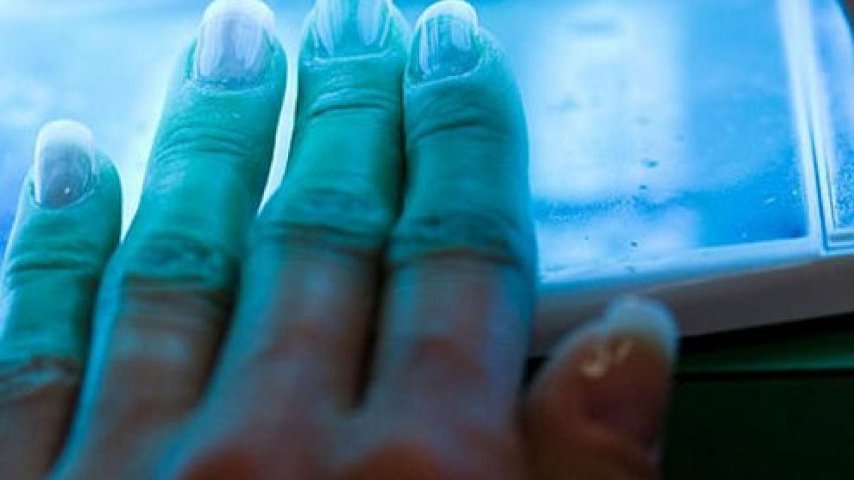 Посещението при маникюрист води до страшна и смъртоносна болест