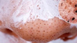 Лесна рецепта за маска от 2 продукта срещу черните точки по лицето