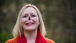 Джейн се изповяда: Кучето ми ме удари в носа и трябваше да ми го отрежат, но всъщност ми спаси живота! (СНИМКИ)