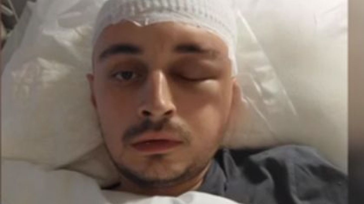 Първи СНИМКИ на оцелелия по чудо Станимир от офиса на разстреляните предприемачи в кв. "Витоша"