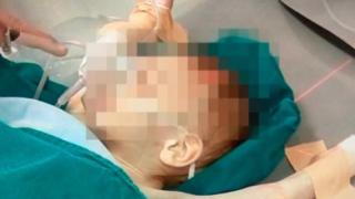 Помните ли недохранените близнаци, които се озоваха в болница след домашен инцидент? Майка им Иванка... 