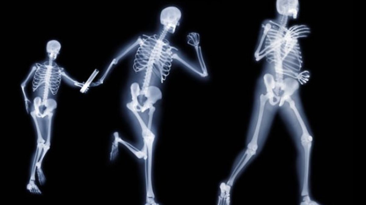 Нещо ужасно се случва с костите ви при липсата на този витамин