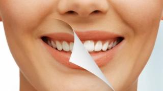 Бърз и лесен домашен метод за избелване на зъбите смая стоматолозите