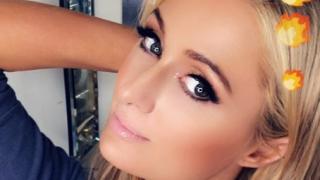 Парис Хилтън се подложи на пластична операция и сега има безупречен ... (СНИМКИ)