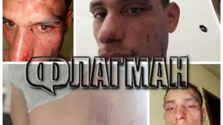 Кръв, бой и свирепа агресия почерниха завършването на Стефан! Пред погледа на приятелката му батки го... (СНИМКИ 18+)