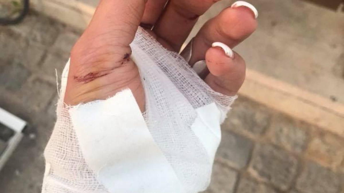 Мис Лято преживя страховит кошмар в софийска градинка, Спешна помощ не праща линейка (СНИМКА 18+)