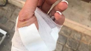 Мис Лято преживя страховит кошмар в софийска градинка, Спешна помощ не праща линейка (СНИМКА 18+)