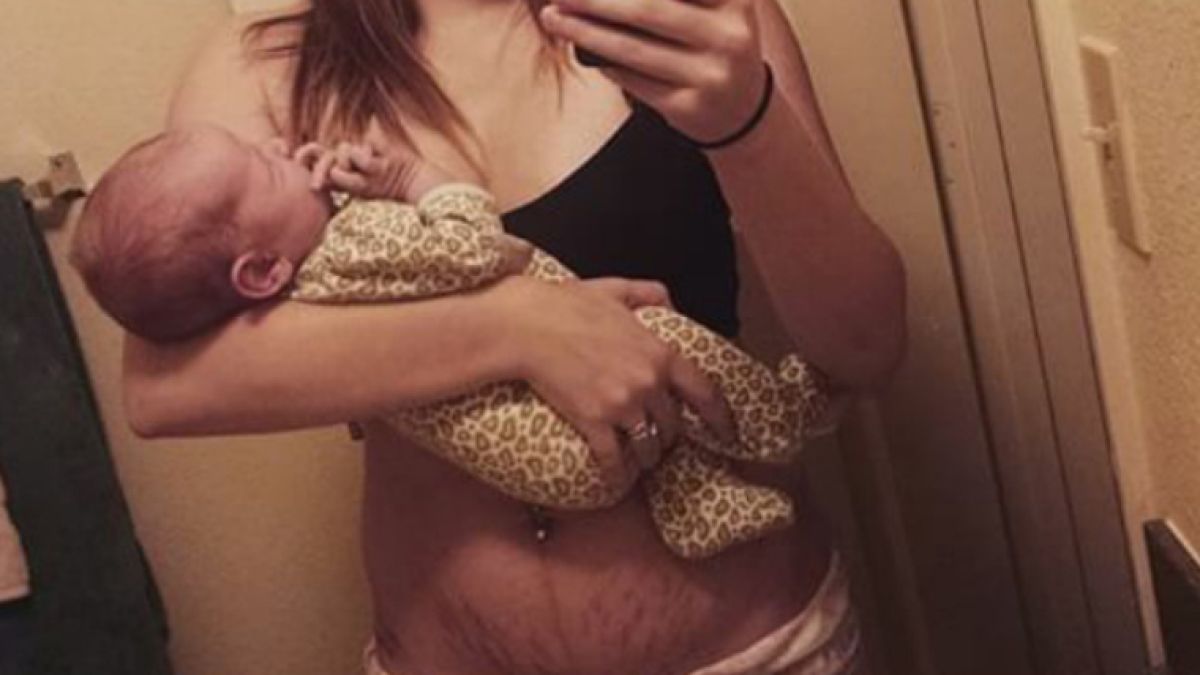 16 смели майки показаха брутално честни СНИМКИ 18+ за това как изглеждат телата им след раждането