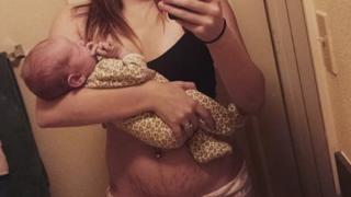 16 смели майки показаха брутално честни СНИМКИ 18+ за това как изглеждат телата им след раждането