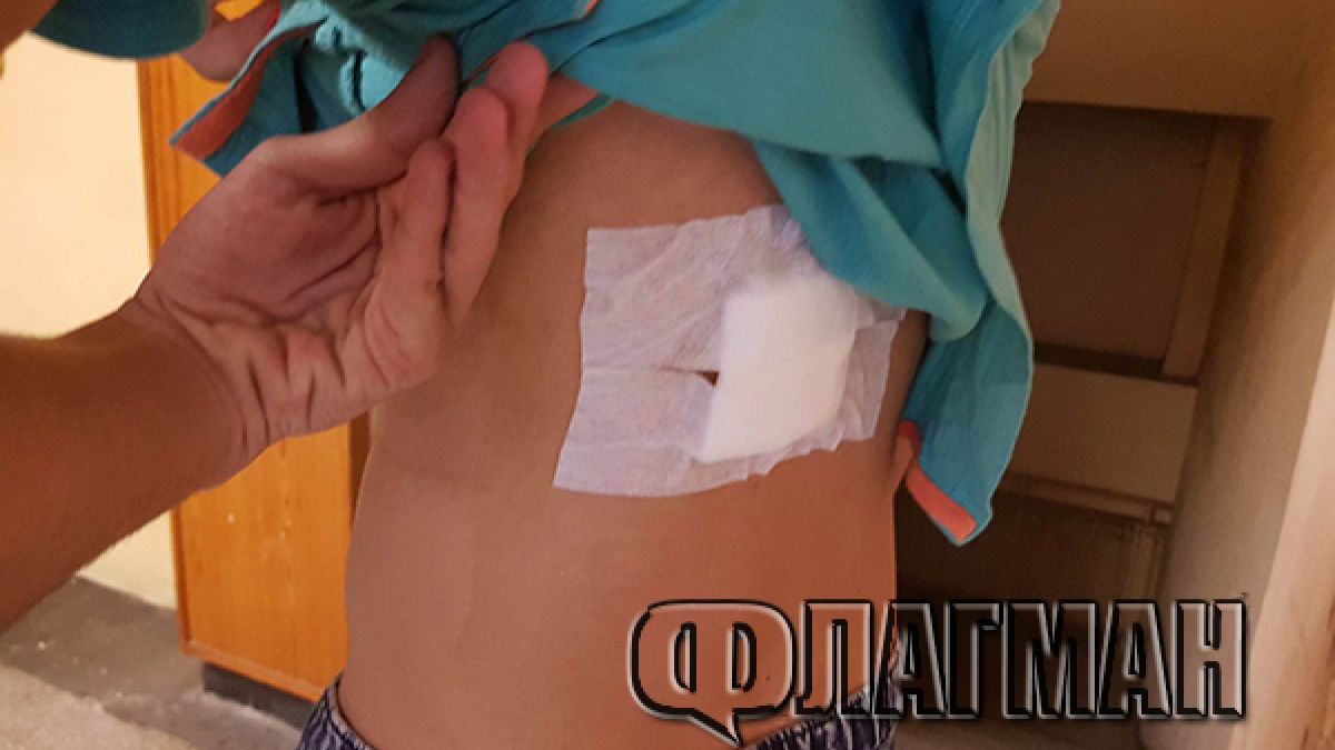 Страшни СНИМКИ на наръгания от агресивен ром 17-годишен Ставри: Крещеше, че ще ме довърши, ако не му дам телефона си!