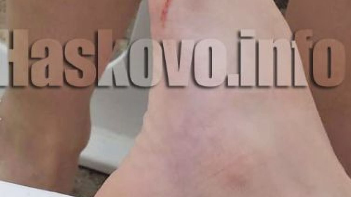 Майка заведе 8-годишния си син на басейн и съжали жестоко (СНИМКИ 18+) 