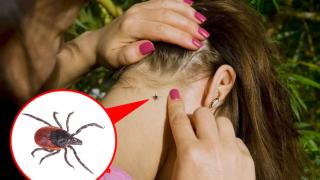 Уникален трик предпазва от кърлежи! Преди да излезете от вкъщи просто трябва да...