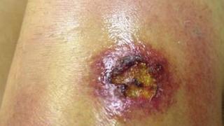 Американка започна да халюцинира и почти не получи удар, след като бе нахапана от десетки отровни паяци (СНИМКИ)