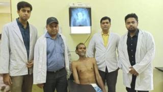 62-годишен индиец живя 10 дни с чаша в ануса, а пред смаяните лекари обясни, че... (СНИМКИ)