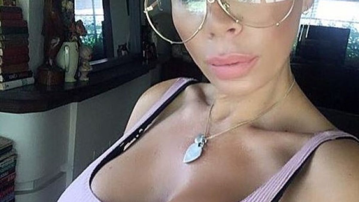 Стриптизьорка отиде при пластичен хирург и след това преживя най-големия кошмар в живота си (СНИМКИ)