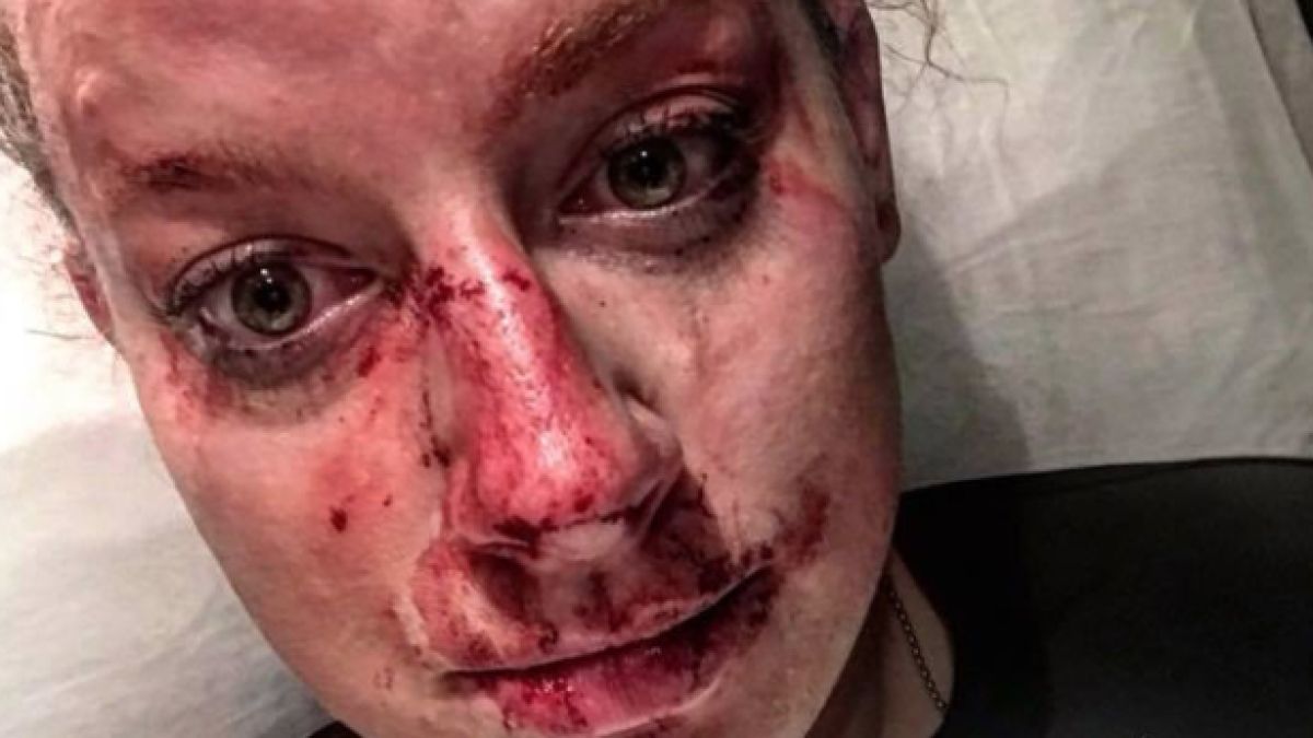 Млада полицайка показа цената на залавянето на откачил наркоман (СНИМКИ)