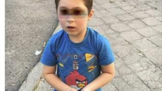 Познавате ли това момченце? Броди изплашено из бургаския кв. "Славейков"  