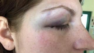 Ужас в Пловдивско! Подивелият Ангел смля от бой Пенка - блъска я с вратата на колата! Потресаващи СНИМКИ (18+)