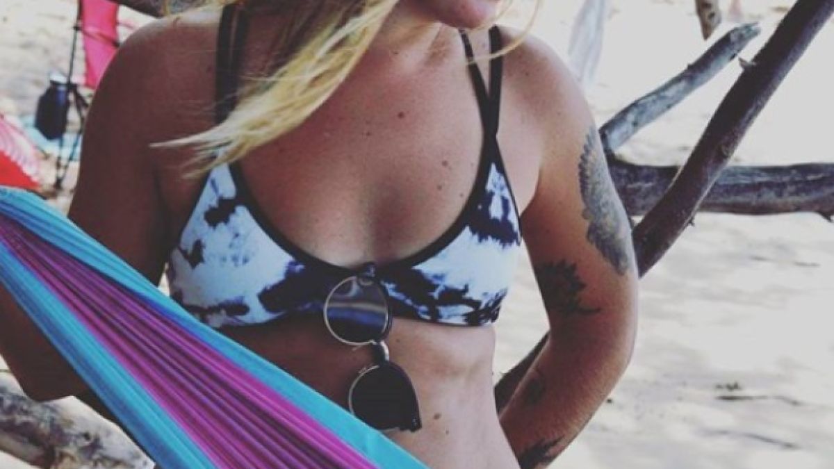 Хората гледат с отвращение тази красива девойка заради странната ѝ болест
