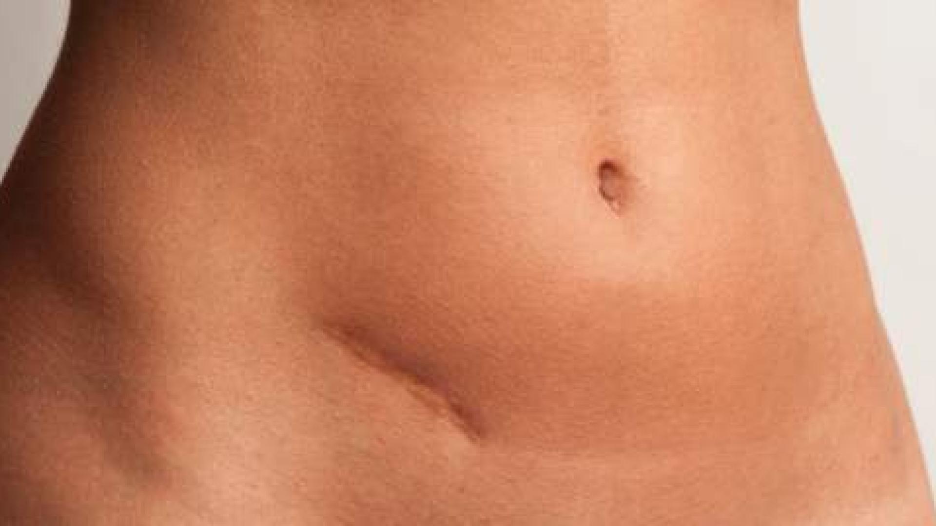 Може ли да се излекува апендицит с хапчета? Вижте отговора!