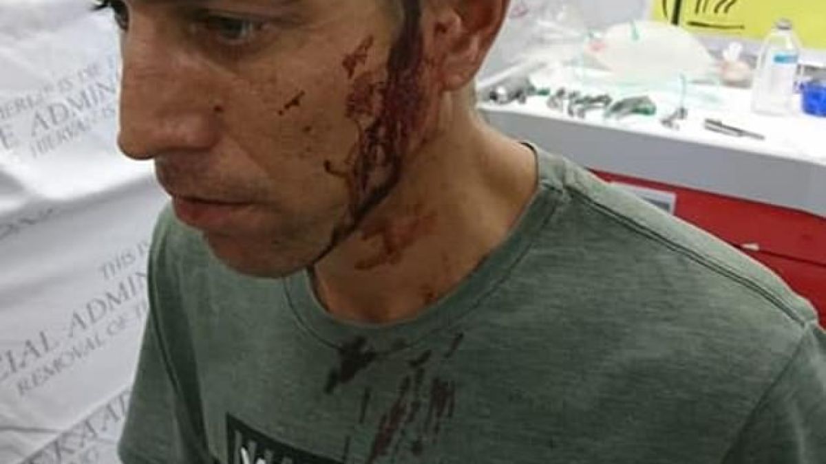 Имате ли свободен лекар: Мъж със забит в главата нож спокойно помоли за помощ (СНИМКИ 18+)
