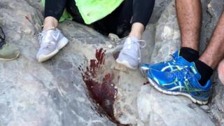 Момиче бе зарязано в локва кръв в планината, след запознанство в социалните мрежи