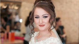 Братя спасиха от смърт красива комбайнерка, замразиха скалпа ѝ за 53 часа, а после...